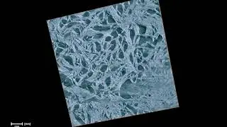 Revealing the remarkable nanostructure of human bone (2)