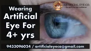 Wearing artificial eye for 4+ yrs now need one more for backup eye | Dr Sumitra