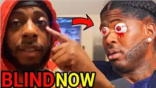 4XTRA MIGHT BE BLIND! Adam22 Admits CRIP Rapper 4xtra Also LOST His 👀 During 🧨 That Took His HAND