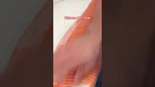 Pinbone Remover