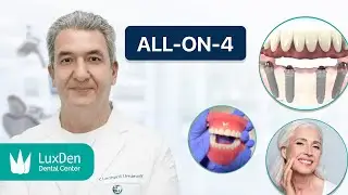 All-on-4 Dental Implants for Full Smile Restoration &ndash; LuxDen Brooklyn