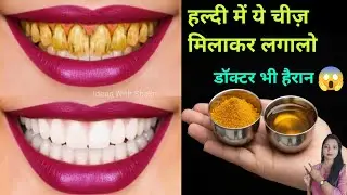 सिर्फ 10 रूपये में गंदे पीले दांतों को मोती की तरह चमका देगा / Teeth whitening remedy /dato ko white