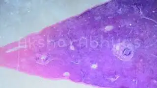 Microscope - Animal Liver Tissue (200x Magnification)