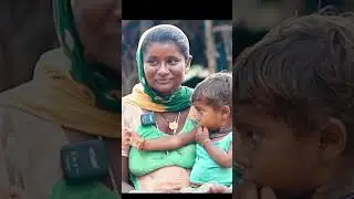 PART 2 દોઢ વર્ષના બાળકનું સફળ ઓપરેશન | Dr. Prabhu Chaudhari | Advance Hospital Patan