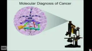 Therapy of lymphoma inspired by functional and structural genomics