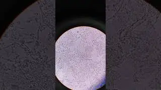 Budding yeast cells under microscope | Urine infection | @medicallabtechnologysajal6903