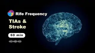 Silent Brain Attack WARNING | TIA/Stoke Prevention & Recovery | Rife Freq To RESTORE NEURAL PATHWAYS
