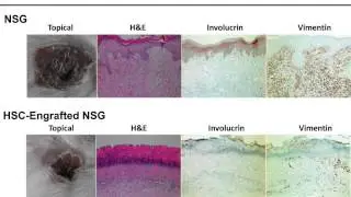 Humanized Mouse Models for Biomedical Research: Selection and Experimental Implications