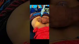 Tail bone adjustment treatment without medicine #tailbone