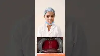 gokul ritika pallavi patient  education video protho pg 1