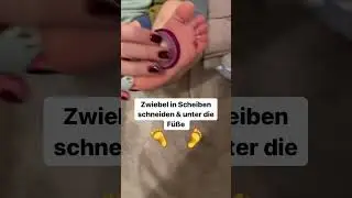 🧦🧅Zwiebelsocken bei Erk&auml;ltung 🤧 | Echte Mamas #momhack #erk&auml;ltung #baby #hack