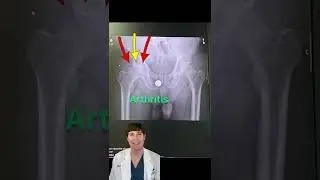 How to read a pelvis X-ray
