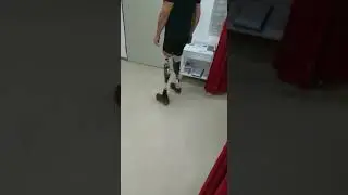 Doppelt amputiert