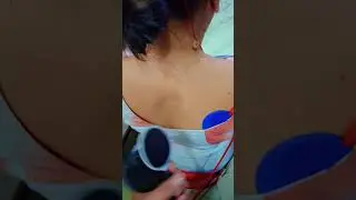 TENS Remove 😱😱 #shortsvideo #tense #motivation #health #doctor #physiotherapy #pt #drwell #physio