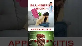 Nurse job /Blumberg sign/Appendicitis /Nursing notes exam/Government job #shorts #nurses #jobs #psc