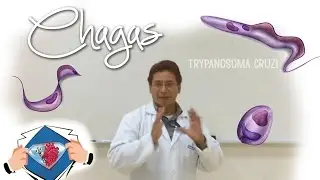 Enfermedad de Chagas - Medical League