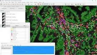 Практические аспекты использования InstanSeg v Cellpose в QuPath для мультиплексной иммунофлуорес...