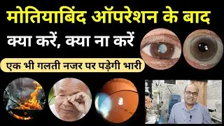 मोतियाबिंद ऑपरेशन के बाद क्या करें, क्या न करें?👁️एक भी गलती पड़ेगी भारी |Cataract Surgery Post Care 