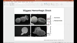Digestive Enzymes On the Loose:  Autodigestion in Metabolic Disease, Shock and Death