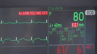 More people suffering heart attacks at younger age, researchers say