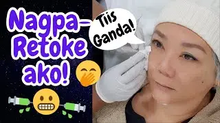 MAG-PAGANDA MUNA! FACIAL PROFILE BALANCING WITH FILLERS😘