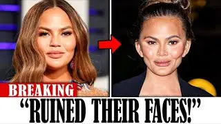 8 Celebrities Who REGRET Their Buccal Fat Removal Surgery