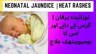 neonatal jaundice | heat rashes and its homeopathic  treatment