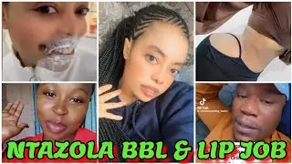 GLORIA NTAZOLA BBL & LIP JOB WORTH KSH 1.8 MILLION CAUSES A BUZZ IN THE INTERNET