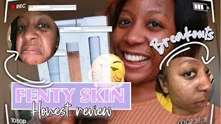 FENTY SKIN | HONEST REVIEW + DEMO ON OILY ACNE PRONE SKIN