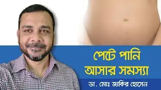 Ascites Treatment - How is ascites treated - পেটে পানি আসলে করণীয় - পেটে পানি জমার লক্ষণ