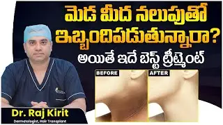 How to Get Rid of Acanthosis Nigricans on the Neck || Dark Neck Causes and Treatment || Celestee