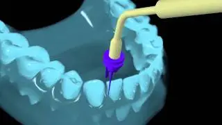 Endodontics, Periodontology and Bleaching
