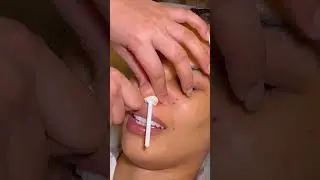 ASMR: Nose Hair Removal! #shorts