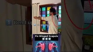 Do This If You Have A Winged Scapula