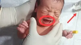 Newborn Baby Care: Initial Assessment, Physiotherapy & Feeding Management🍼🩺
