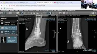 LONG CASE F&A