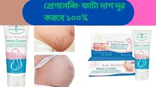 Anti-Stretch mark cream reviews.এন্টি স্ট্রেস মার্ক ক্রীম রিভিউ, Anti-Stretch mark cream. anti mark