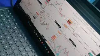 Gambling karne mein aur trading karne mein fark hota Hai bro #short #shorts