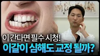 이갈이 심한데 치아교정 하면 생기는 일 (feat. 장치 추천)