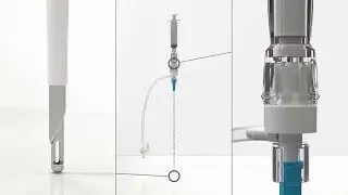Safe-T-Centesis&trade; catheter drainage system video