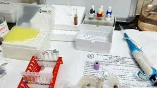 Gel card se cross match kaise lagte hai |Crossmatch of blood by gel card method| #hospital #doctor