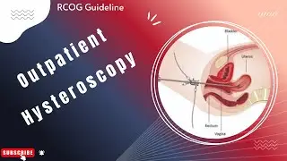 Outpatient Hysteroscopy RCOG Guideline (Green-top Guideline, August 2024)