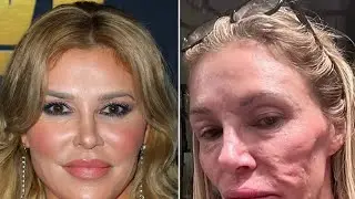 Brandi Glanville Gives Health Battle Update: &lsquo;Finally Getting Answers&rsquo;