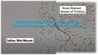 Bacteria in Saline wet mount and Gram Stained Microscopy at various magnifications
