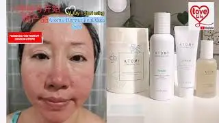 Holla! Surprise‼️📣💯 REAL DERMA TESTED REAL CICA | Derma Real Cica Set | BEST Cleanser and Skincare 💙