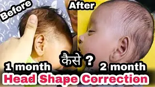 Newborn baby head shape correction - baby head shape - conehead baby - priya vlogs indian vlogs 2022