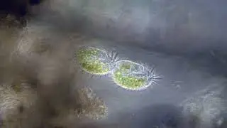 Stylonychia undergoing binary fission