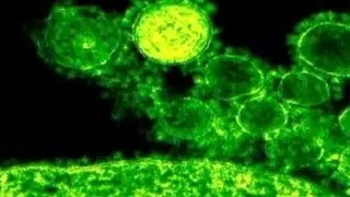 MERS virus is deadly but not an emergency, says WHO