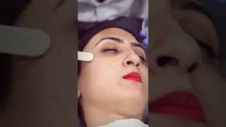 Radio frequency (RF) treatment for instant glowing skin | #shorts #viral #RF skin tightening