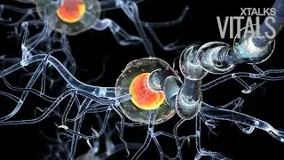 Teva&rsquo;s New Treatment for Huntington&rsquo;s Disease Approved by FDA